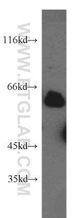 STAU2 Antibody in Western Blot (WB)