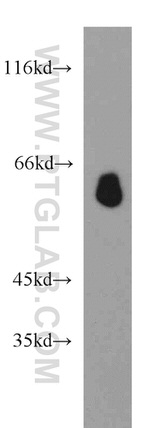 STAU2 Antibody in Western Blot (WB)