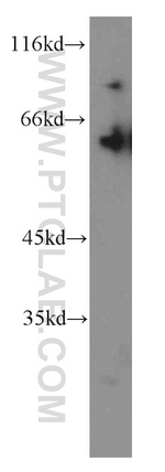 STAU2 Antibody in Western Blot (WB)