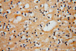 FGL1 Antibody in Immunohistochemistry (Paraffin) (IHC (P))