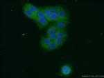 RPL27A Antibody in Immunocytochemistry (ICC/IF)