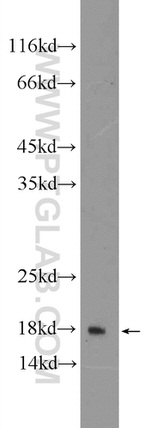 RPL27A Antibody in Western Blot (WB)