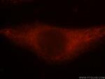 NBR1 Antibody in Immunocytochemistry (ICC/IF)