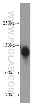 NBR1 Antibody in Western Blot (WB)