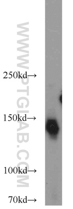 NBR1 Antibody in Western Blot (WB)
