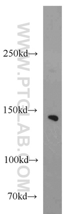 NBR1 Antibody in Western Blot (WB)
