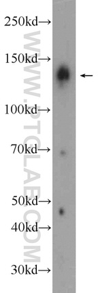 NBR1 Antibody in Western Blot (WB)