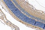 Alpha Tubulin Antibody in Immunohistochemistry (Paraffin) (IHC (P))