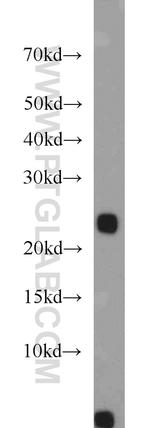 PLA2G12A Antibody in Western Blot (WB)