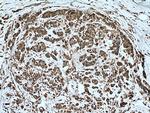 TXNDC4 Antibody in Immunohistochemistry (Paraffin) (IHC (P))