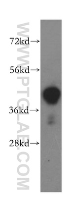 ILKAP Antibody in Western Blot (WB)