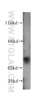 NAP1L4 Antibody in Western Blot (WB)