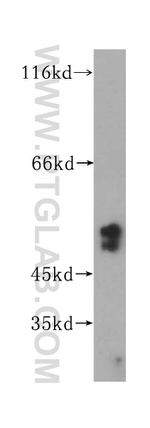 NAP1L4 Antibody in Western Blot (WB)