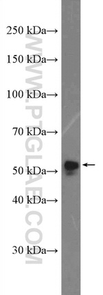 NAP1L4 Antibody in Western Blot (WB)