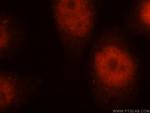 DBR1 Antibody in Immunocytochemistry (ICC/IF)