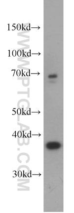 GALM Antibody in Western Blot (WB)
