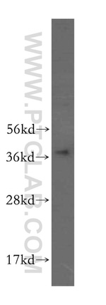GALM Antibody in Western Blot (WB)