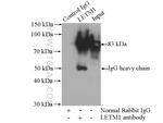 LETM1 Antibody in Immunoprecipitation (IP)