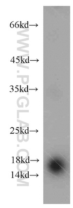 CST1 Antibody in Western Blot (WB)