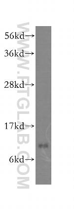 S100A1 Antibody in Western Blot (WB)