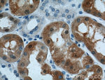 S100A1 Antibody in Immunohistochemistry (Paraffin) (IHC (P))