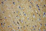 MANBAL Antibody in Immunohistochemistry (Paraffin) (IHC (P))