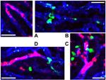 CD31 (PECAM-1) Antibody in Immunohistochemistry (IHC)