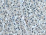 NDUFB6 Antibody in Immunohistochemistry (Paraffin) (IHC (P))