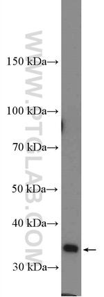 TUSC3 Antibody in Western Blot (WB)