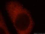 IFFO1 Antibody in Immunocytochemistry (ICC/IF)