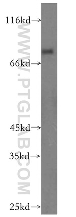 IFFO1 Antibody in Western Blot (WB)