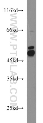 BCCIP Antibody in Western Blot (WB)