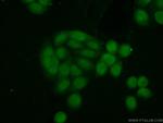 BCCIP Antibody in Immunocytochemistry (ICC/IF)