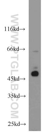 BCCIP Antibody in Western Blot (WB)