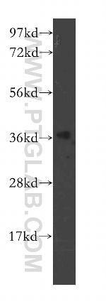 POLR3F Antibody in Western Blot (WB)