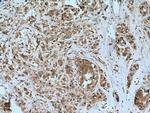 PFDN4 Antibody in Immunohistochemistry (Paraffin) (IHC (P))