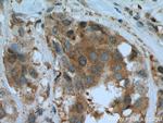 PFDN4 Antibody in Immunohistochemistry (Paraffin) (IHC (P))