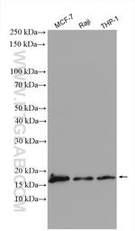 PFDN4 Antibody in Western Blot (WB)