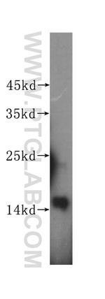 PFDN4 Antibody in Western Blot (WB)