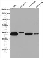 SNX15 Antibody in Western Blot (WB)
