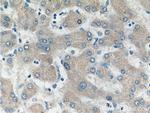 SULT1B1 Antibody in Immunohistochemistry (Paraffin) (IHC (P))