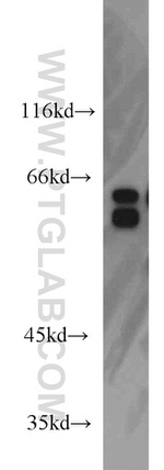 MYEF2 Antibody in Western Blot (WB)