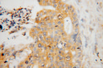 ATP6V1C1 Antibody in Immunohistochemistry (Paraffin) (IHC (P))