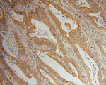 LYPLA1 Antibody in Immunohistochemistry (Paraffin) (IHC (P))