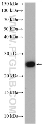 LYPLA1 Antibody in Western Blot (WB)