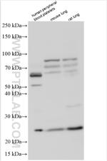 SAP30L Antibody in Western Blot (WB)