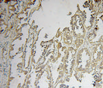 PMPCB Antibody in Immunohistochemistry (Paraffin) (IHC (P))