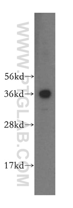 RDH13 Antibody in Western Blot (WB)