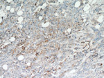 GCDFP-15/PIP Antibody in Immunohistochemistry (Paraffin) (IHC (P))
