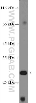 XRCC6BP1 Antibody in Western Blot (WB)